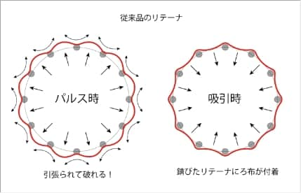 従来品のリテーナ